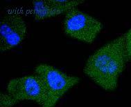 HUABIO ET1612-19 image 1