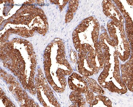 HUABIO ET1612-19 image 2