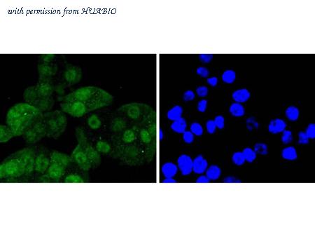 HUABIO ET1612-3 image 3