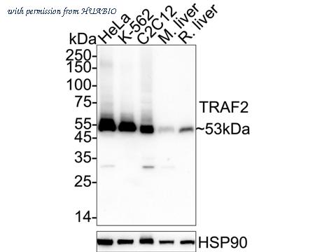 HUABIO ET1612-5 image 1