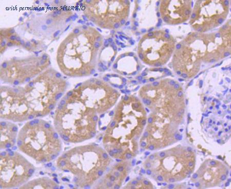 HUABIO ET1612-5 image 2