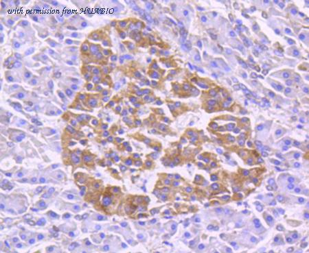 HUABIO ET1612-5 image 3