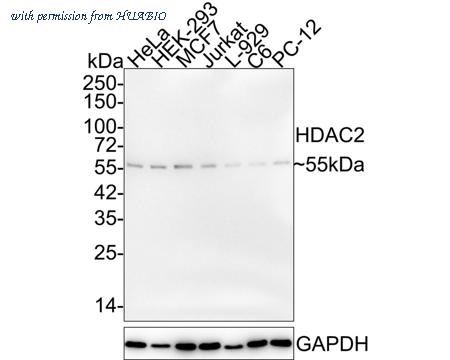 HUABIO ET1612-50 image 1