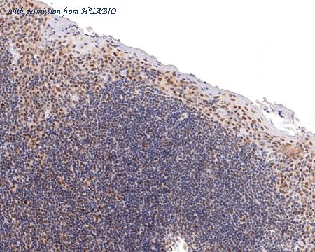 HUABIO ET1612-50 image 3