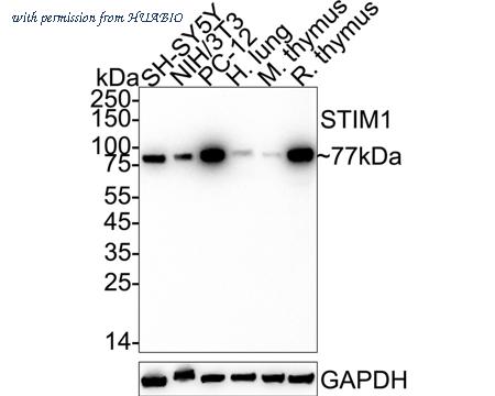 HUABIO ET1612-53 image 1