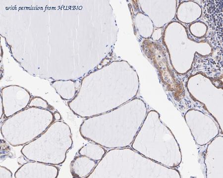 HUABIO ET1612-53 image 2