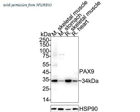 HUABIO ET1612-59 image 1