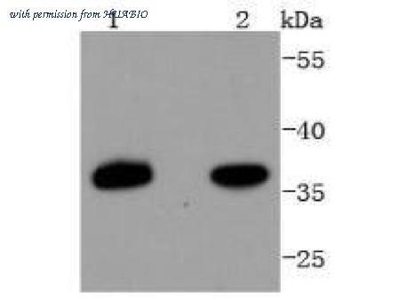 HUABIO ET1612-59 image 2