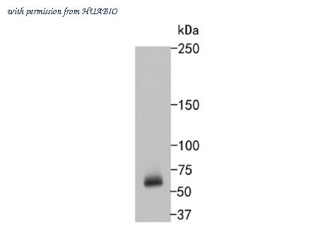 HUABIO ET1612-76 image 2