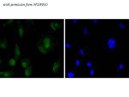 HUABIO ET1612-76 image 3