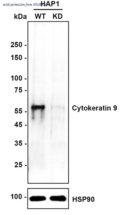 HUABIO ET1612-77 image 1