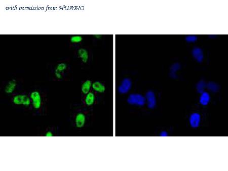 HUABIO ET1612-78 image 2