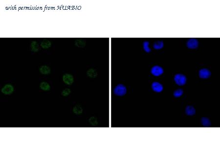 HUABIO ET1612-78 image 3