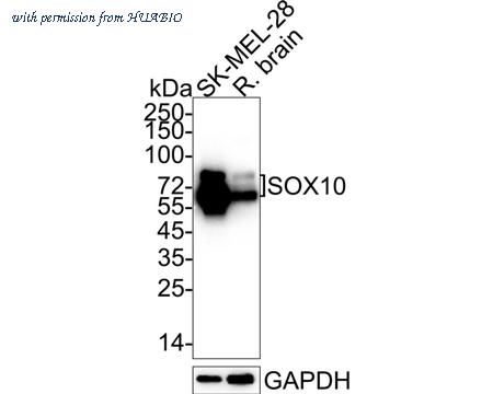 HUABIO ET1612-79 image 2