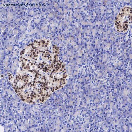 HUABIO ET1612-89 image 2