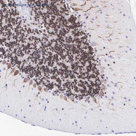 HUABIO ET1612-89 image 3