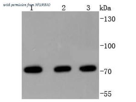 HUABIO ET1701-15 image 1
