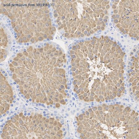 HUABIO ET1701-15 image 2