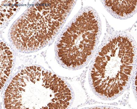 HUABIO ET1701-15 image 3