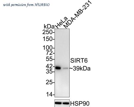HUABIO ET1701-29 image 1