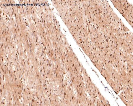 HUABIO ET1701-3 image 3