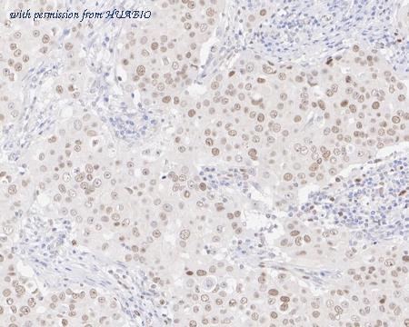 HUABIO ET1701-56 image 1