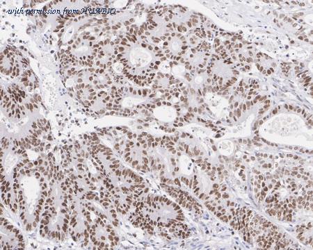 HUABIO ET1701-56 image 2