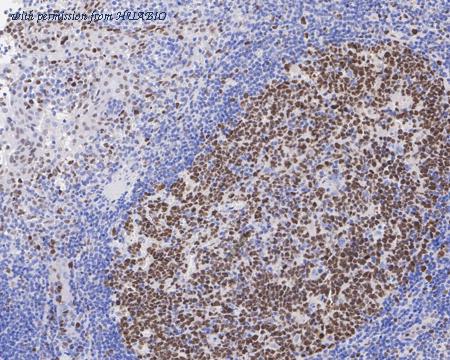 HUABIO ET1701-56 image 3