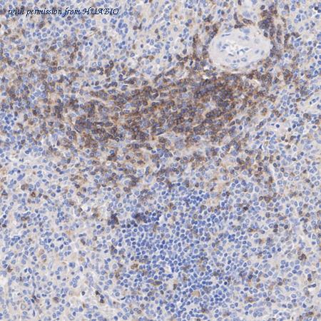 HUABIO ET1701-57 image 3