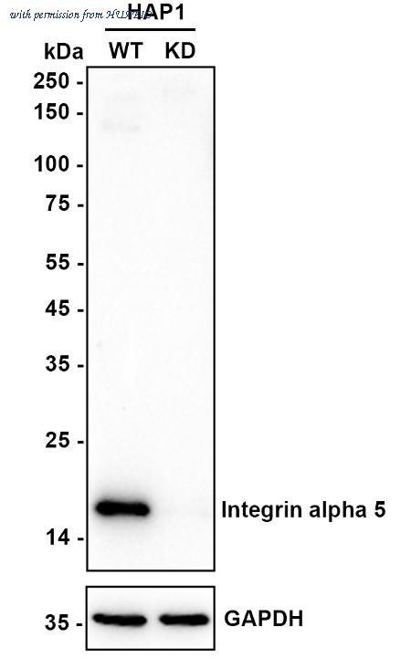 HUABIO ET1701-58 image 2