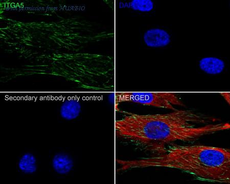 HUABIO ET1701-58 image 3
