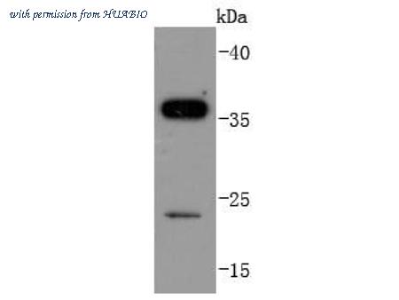 HUABIO ET1701-6 image 1
