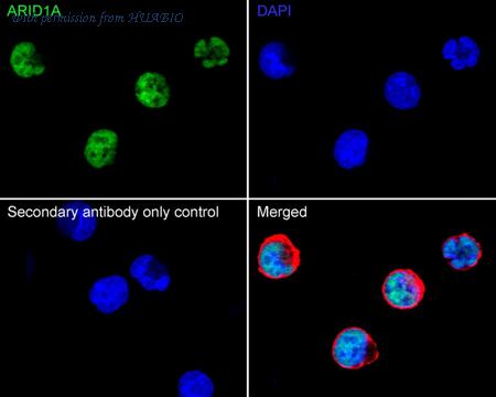 HUABIO ET1701-60 image 2