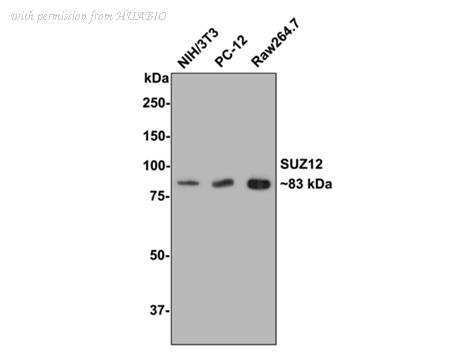 HUABIO ET1701-62 image 1