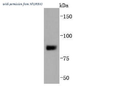 HUABIO ET1701-62 image 2