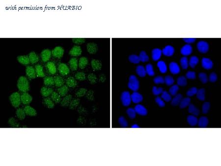 HUABIO ET1701-62 image 3