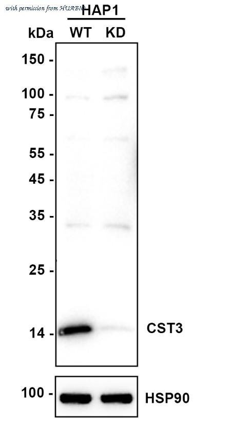 HUABIO ET1701-72 image 1