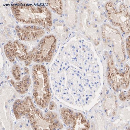 HUABIO ET1701-72 image 3