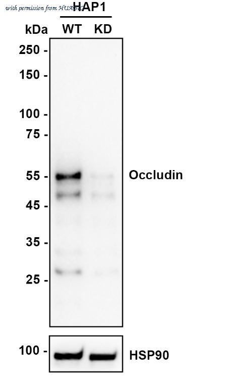 HUABIO ET1701-76 image 1