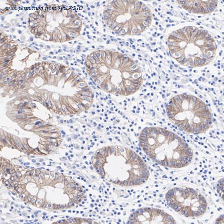 HUABIO ET1701-76 image 3