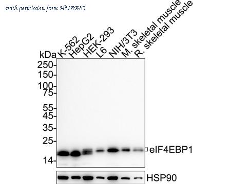 HUABIO ET1701-83 image 1
