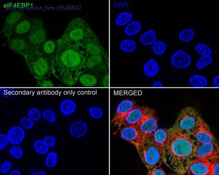 HUABIO ET1701-83 image 2