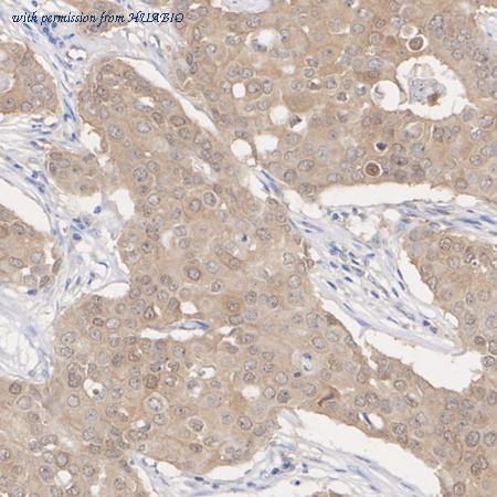 HUABIO ET1701-83 image 3