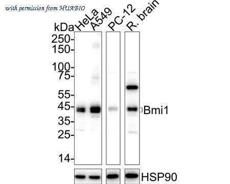 HUABIO ET1701-89 image 1