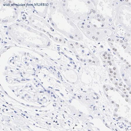 HUABIO ET1701-89 image 2