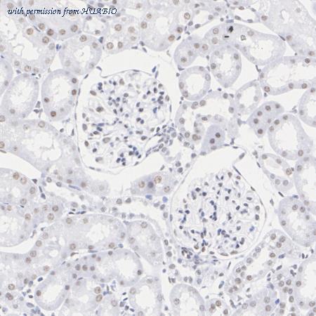 HUABIO ET1701-89 image 3