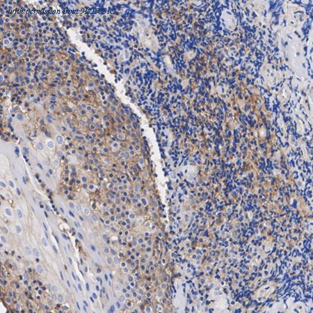 HUABIO ET1701-92 image 2