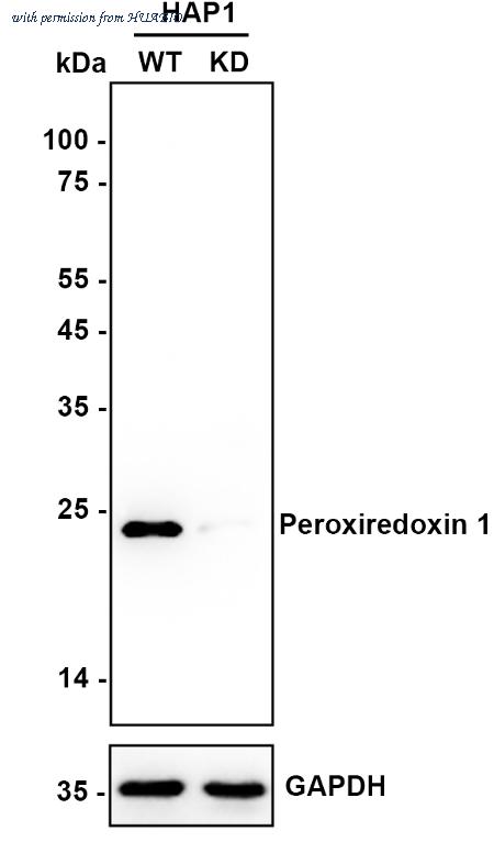 HUABIO ET1702-08 image 2