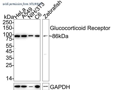 HUABIO ET1702-11 image 1