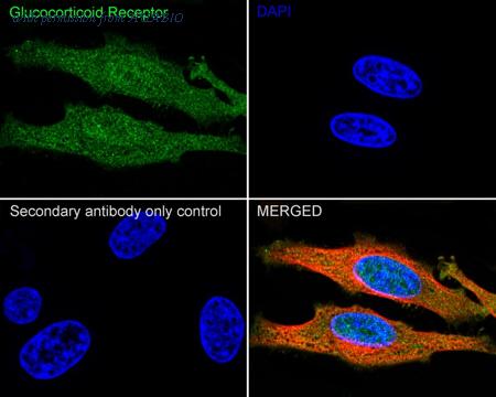 HUABIO ET1702-11 image 2